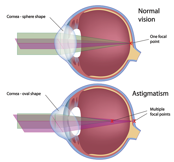 paterson best eye surgeon